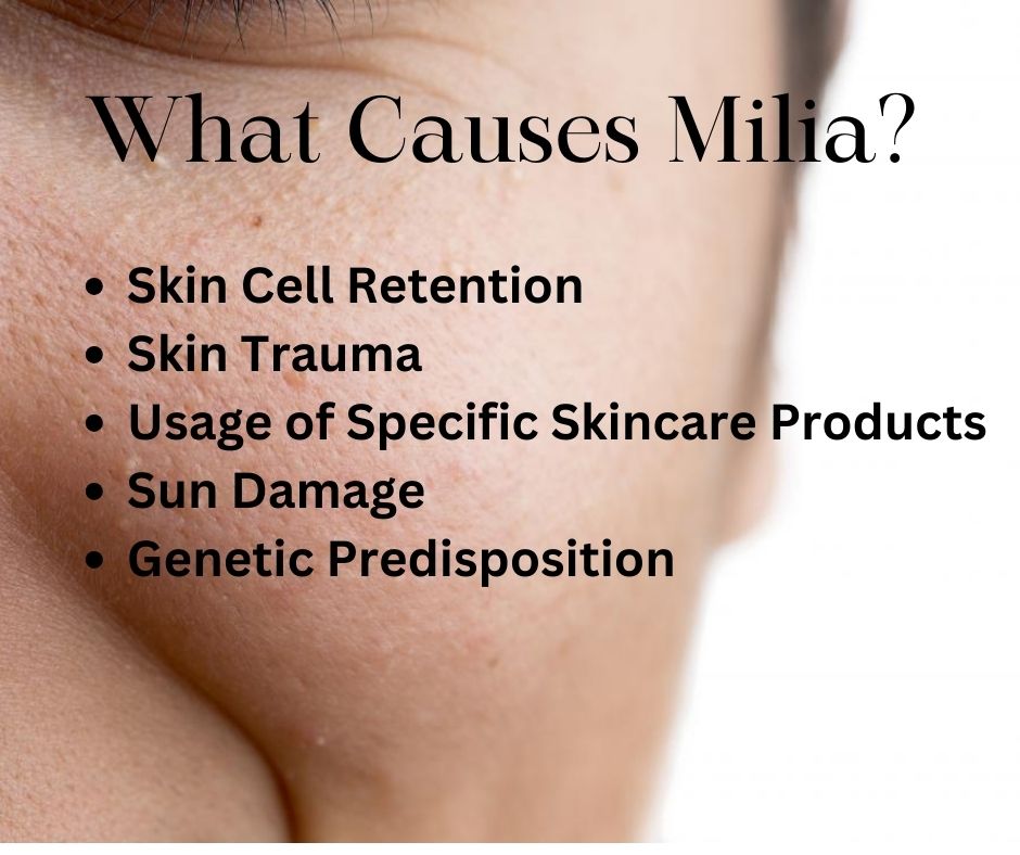 What is Milia 1